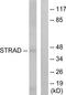 STE20-related kinase adapter protein alpha antibody, TA315988, Origene, Western Blot image 