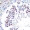 Cellular Communication Network Factor 5 antibody, GTX33585, GeneTex, Immunohistochemistry paraffin image 