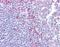Delta Like Canonical Notch Ligand 1 antibody, NBP1-59217, Novus Biologicals, Immunohistochemistry paraffin image 