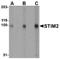 Stromal Interaction Molecule 2 antibody, AP05701PU-N, Origene, Western Blot image 