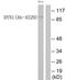 Dynamin-I antibody, TA313759, Origene, Western Blot image 