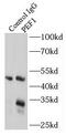 Penta-EF-Hand Domain Containing 1 antibody, FNab06301, FineTest, Immunoprecipitation image 