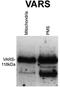 Valyl-TRNA Synthetase antibody, TA339296, Origene, Western Blot image 