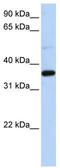 Prostaglandin reductase 1 antibody, TA334445, Origene, Western Blot image 