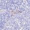 FOXP3 antibody, NBP2-24397, Novus Biologicals, Immunohistochemistry paraffin image 
