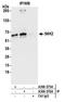 Ribosomal Protein S6 Kinase B2 antibody, A300-576A, Bethyl Labs, Immunoprecipitation image 