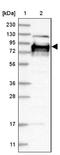 Heparan Sulfate 6-O-Sulfotransferase 2 antibody, NBP1-90913, Novus Biologicals, Immunohistochemistry frozen image 