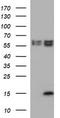 Microseminoprotein Beta antibody, TA803513BM, Origene, Western Blot image 