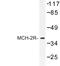 Melanin Concentrating Hormone Receptor 2 antibody, LS-C177103, Lifespan Biosciences, Western Blot image 