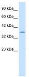 Interleukin enhancer-binding factor 2 antibody, TA339093, Origene, Western Blot image 