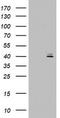 Ornithine Carbamoyltransferase antibody, TA802396BM, Origene, Western Blot image 