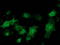 E3 ubiquitin-protein ligase MGRN1 antibody, TA502681, Origene, Immunofluorescence image 