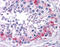 Abraxas 1, BRCA1 A Complex Subunit antibody, 51-572, ProSci, Immunohistochemistry paraffin image 