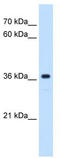 MAS1 Proto-Oncogene, G Protein-Coupled Receptor antibody, TA339888, Origene, Western Blot image 