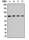 Protein Arginine Methyltransferase 7 antibody, LS-C668803, Lifespan Biosciences, Western Blot image 