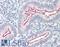 BCAR1 Scaffold Protein, Cas Family Member antibody, LS-B10570, Lifespan Biosciences, Immunohistochemistry paraffin image 