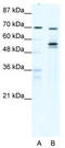 DEAD-Box Helicase 55 antibody, TA341612, Origene, Western Blot image 