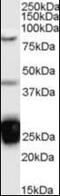 Nucleolysin TIA-1 antibody, orb89306, Biorbyt, Western Blot image 