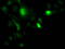 Uridine-cytidine kinase 1 antibody, M08569, Boster Biological Technology, Immunofluorescence image 