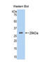Tryptase Beta 2 (Gene/Pseudogene) antibody, LS-C296829, Lifespan Biosciences, Western Blot image 