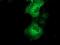 Quinolinate Phosphoribosyltransferase antibody, MA5-25198, Invitrogen Antibodies, Immunocytochemistry image 