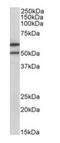 Interleukin 13 Receptor Subunit Alpha 2 antibody, orb318751, Biorbyt, Western Blot image 