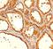 Thyroglobulin antibody, orb248557, Biorbyt, Immunohistochemistry paraffin image 