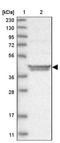 Alanine--Glyoxylate And Serine--Pyruvate Aminotransferase antibody, NBP2-34198, Novus Biologicals, Western Blot image 
