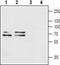 Purinergic Receptor P2X 1 antibody, TA329003, Origene, Western Blot image 