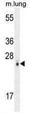 CCAAT Enhancer Binding Protein Delta antibody, AP50849PU-N, Origene, Western Blot image 