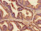 Claudin 3 antibody, orb400596, Biorbyt, Immunohistochemistry paraffin image 