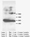 Fatty Acid Binding Protein 1 antibody, LS-C172025, Lifespan Biosciences, Western Blot image 