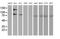 Alcohol Dehydrogenase 1B (Class I), Beta Polypeptide antibody, MA5-25524, Invitrogen Antibodies, Western Blot image 