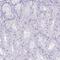 Keratin, type II cytoskeletal 78 antibody, PA5-58902, Invitrogen Antibodies, Immunohistochemistry paraffin image 