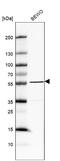 Matrix Remodeling Associated 8 antibody, NBP2-30993, Novus Biologicals, Western Blot image 