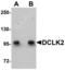 Doublecortin Like Kinase 2 antibody, TA306936, Origene, Western Blot image 