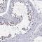 Lysine-specific demethylase 4D antibody, HPA055854, Atlas Antibodies, Immunohistochemistry paraffin image 