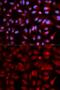 Proteasome Subunit Beta 5 antibody, GTX55762, GeneTex, Immunocytochemistry image 