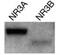 Glutamate Ionotropic Receptor NMDA Type Subunit 3A antibody, GTX22639, GeneTex, Western Blot image 