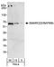 SWI/SNF Related, Matrix Associated, Actin Dependent Regulator Of Chromatin, Subfamily D, Member 2 antibody, NB100-79838, Novus Biologicals, Western Blot image 