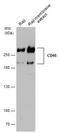 CD45 antibody, GTX628507, GeneTex, Western Blot image 