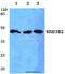 Hydroxy-Delta-5-Steroid Dehydrogenase, 3 Beta- And Steroid Delta-Isomerase 2 antibody, A02012, Boster Biological Technology, Western Blot image 