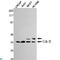 CRK Proto-Oncogene, Adaptor Protein antibody, LS-C812926, Lifespan Biosciences, Western Blot image 