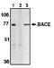 Beta-Secretase 1 antibody, AP05096PU-N, Origene, Western Blot image 