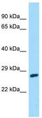 Calcium-binding protein 7 antibody, TA331547, Origene, Western Blot image 