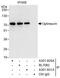 Optineurin antibody, A301-829A, Bethyl Labs, Immunoprecipitation image 