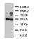 Hydroxysteroid 17-Beta Dehydrogenase 2 antibody, orb76118, Biorbyt, Western Blot image 