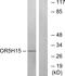 Olfactory Receptor Family 5 Subfamily H Member 15 antibody, GTX86966, GeneTex, Western Blot image 