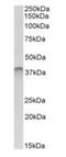 SPO11 Initiator Of Meiotic Double Stranded Breaks antibody, orb146464, Biorbyt, Western Blot image 