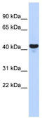 E2F2 antibody, TA343440, Origene, Western Blot image 